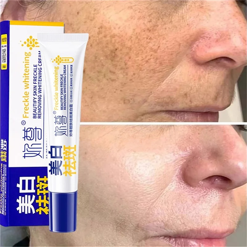 كريم تبييض قوي لإزالة البقع يف - مراجعة Night Cream وسعره