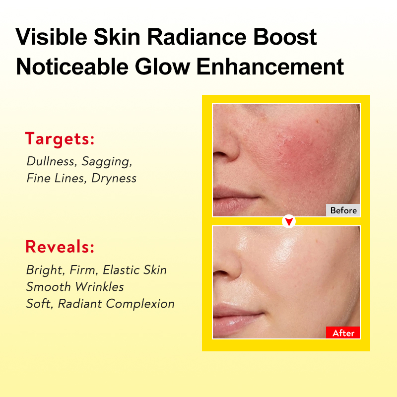 كريم كبسولات فيتامين سي و إي م - مراجعة Vitamin C Serum وسعره