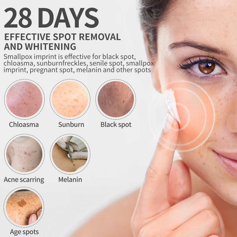 Dimollaure كريم تبييض النمش تر - مراجعة Retinol Cream وسعره
