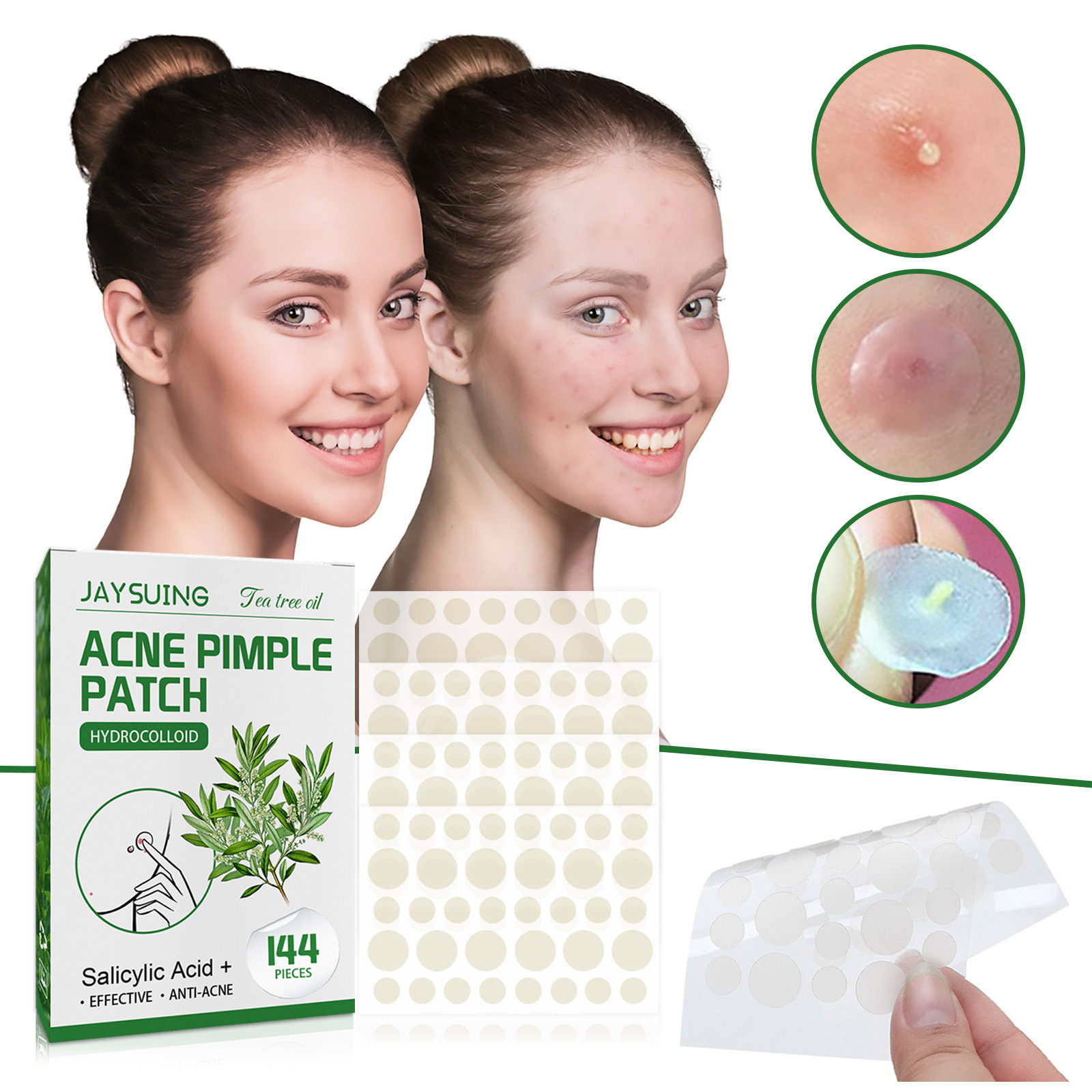رقع حب الشباب الغروانية المائي - مراجعة Face Moisturizer وسعره