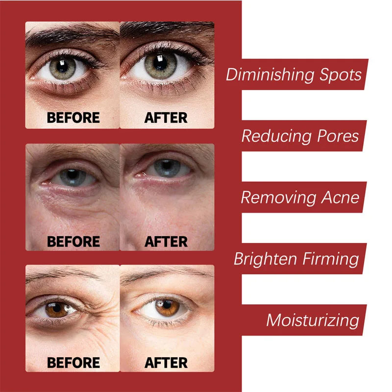 كريم الريتينول مرطب للعناية با - مراجعة Retinol Cream وسعره