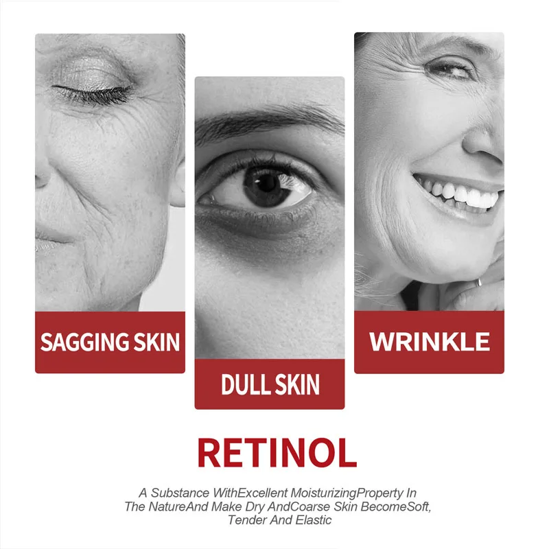 كريم الريتينول مرطب للعناية با - مراجعة Retinol Cream وسعره